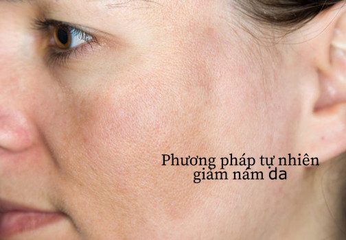Phương pháp tự nhiên để giảm thiểu nám da
